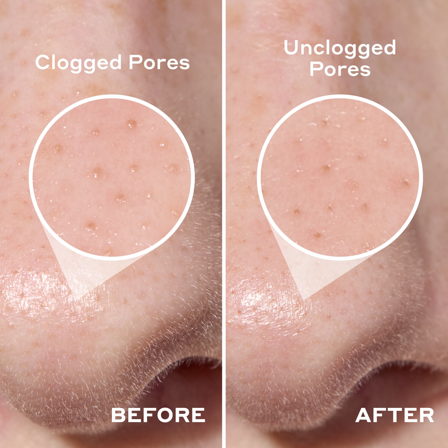 2-in-1 Deep Cleansing Pore Strip