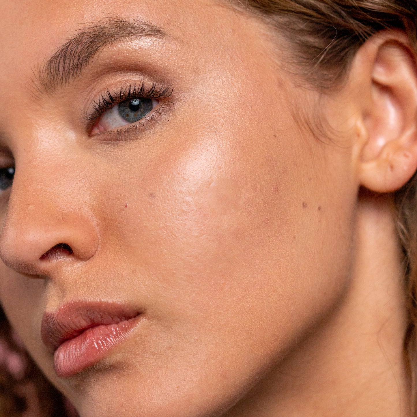 Woman showing Drying Patch applied to her face 