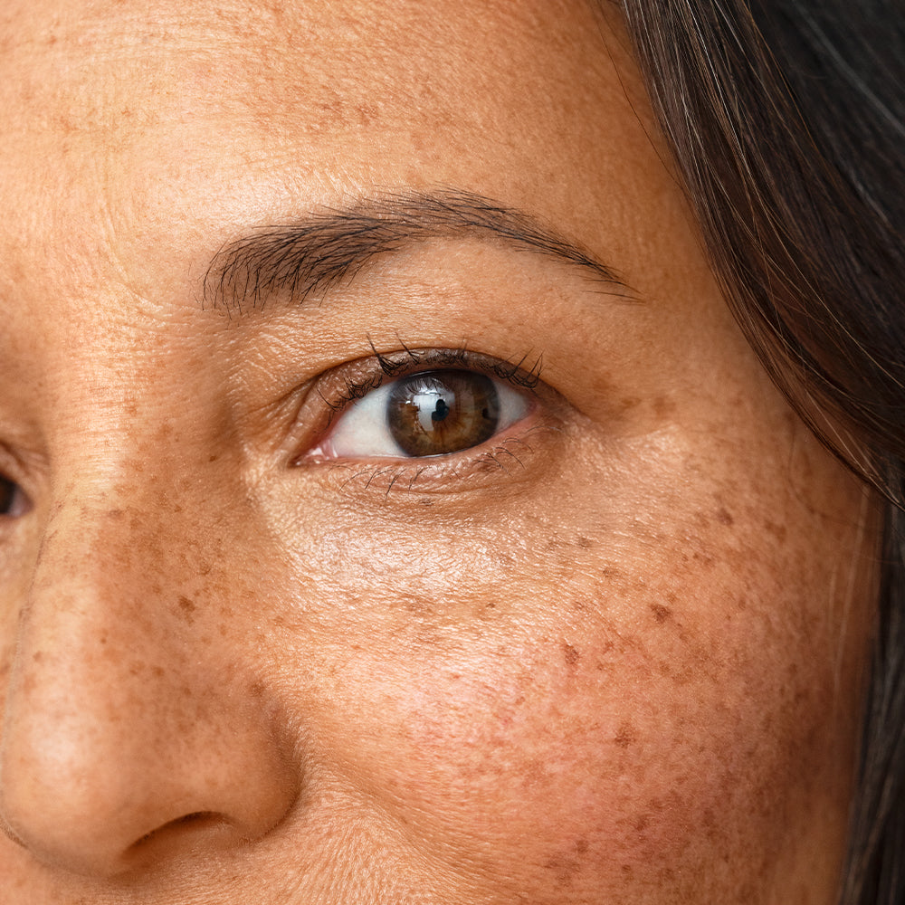 5 Ways to Combat Crow's Feet – Mario Badescu