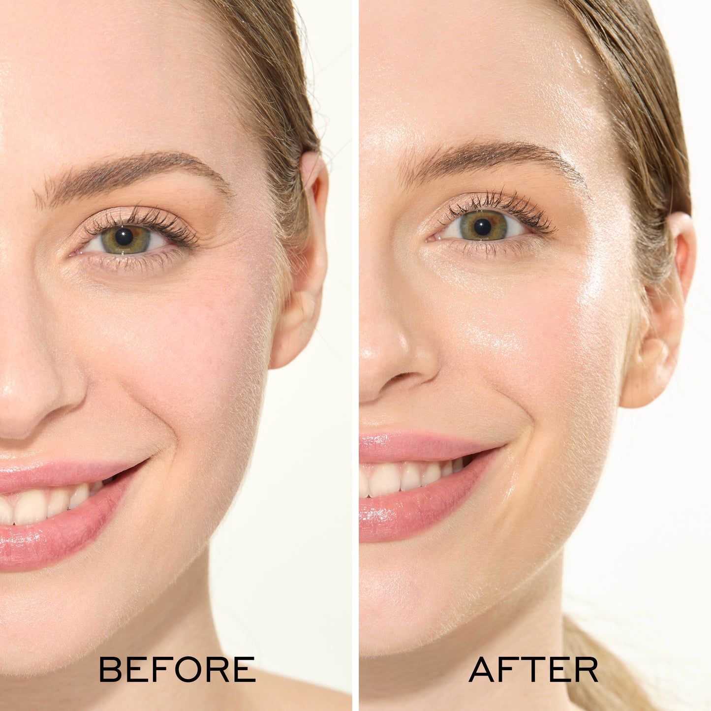 Before and after comparison of a woman's face with visible skin improvement.
