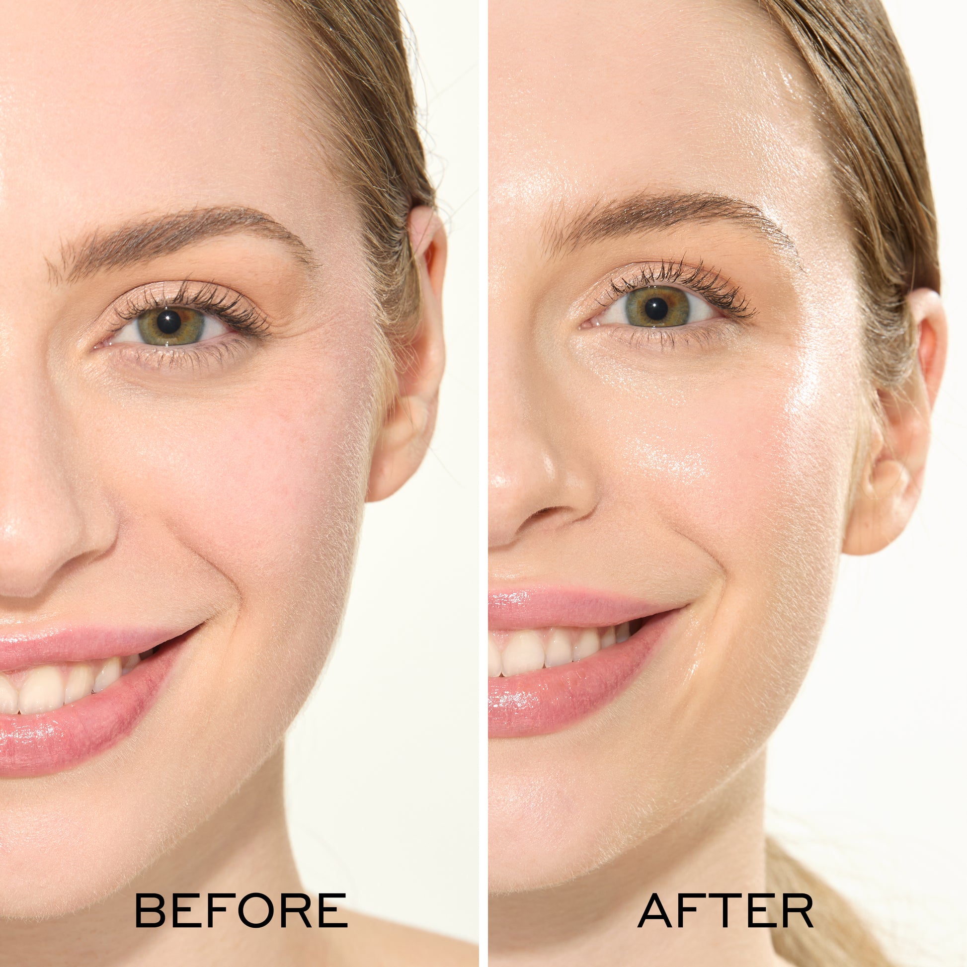 Before and after comparison of a woman's face with visible skin improvement.