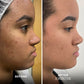 Skin Perfecting Balm with Salicylic Acid